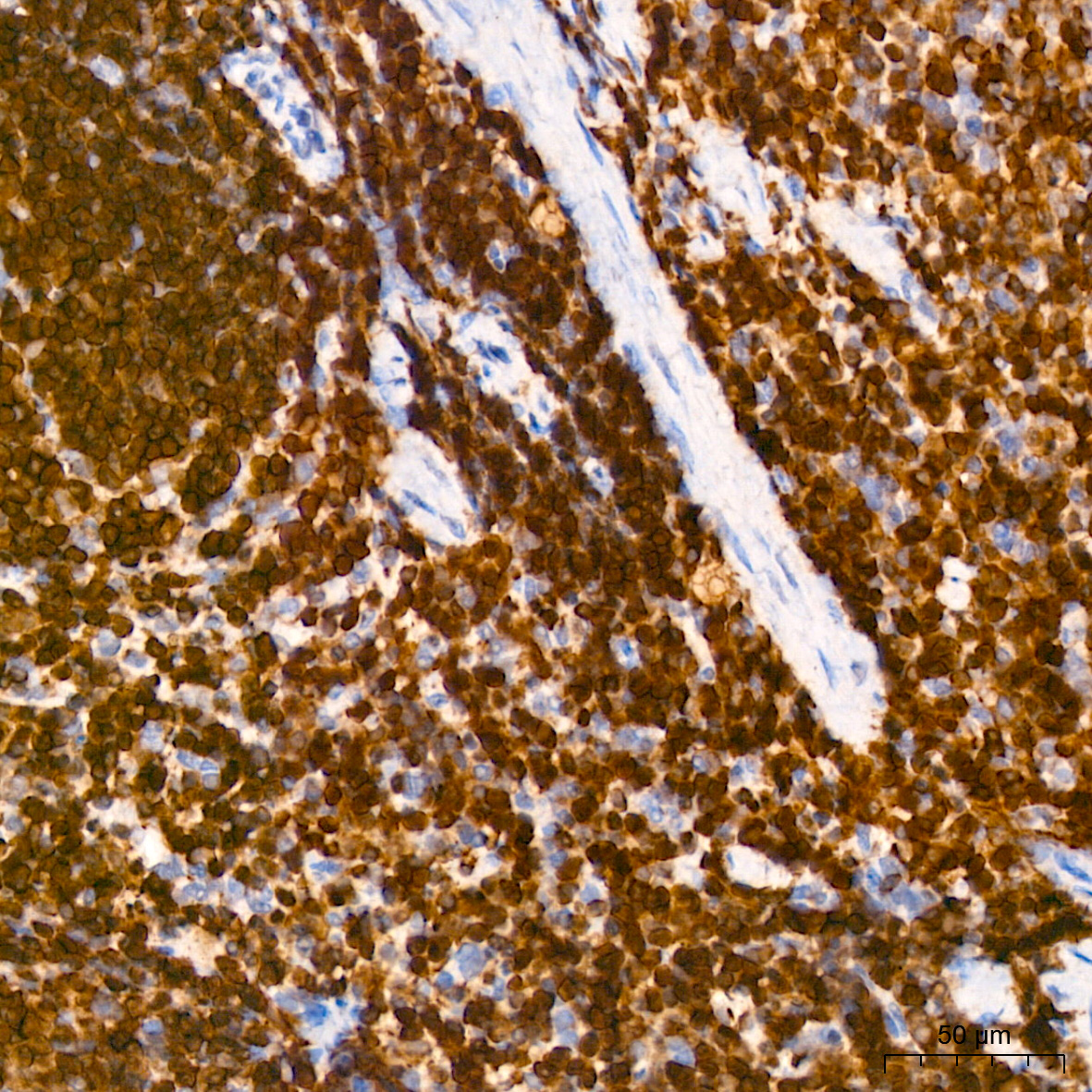 SHP1 Rabbit mAb