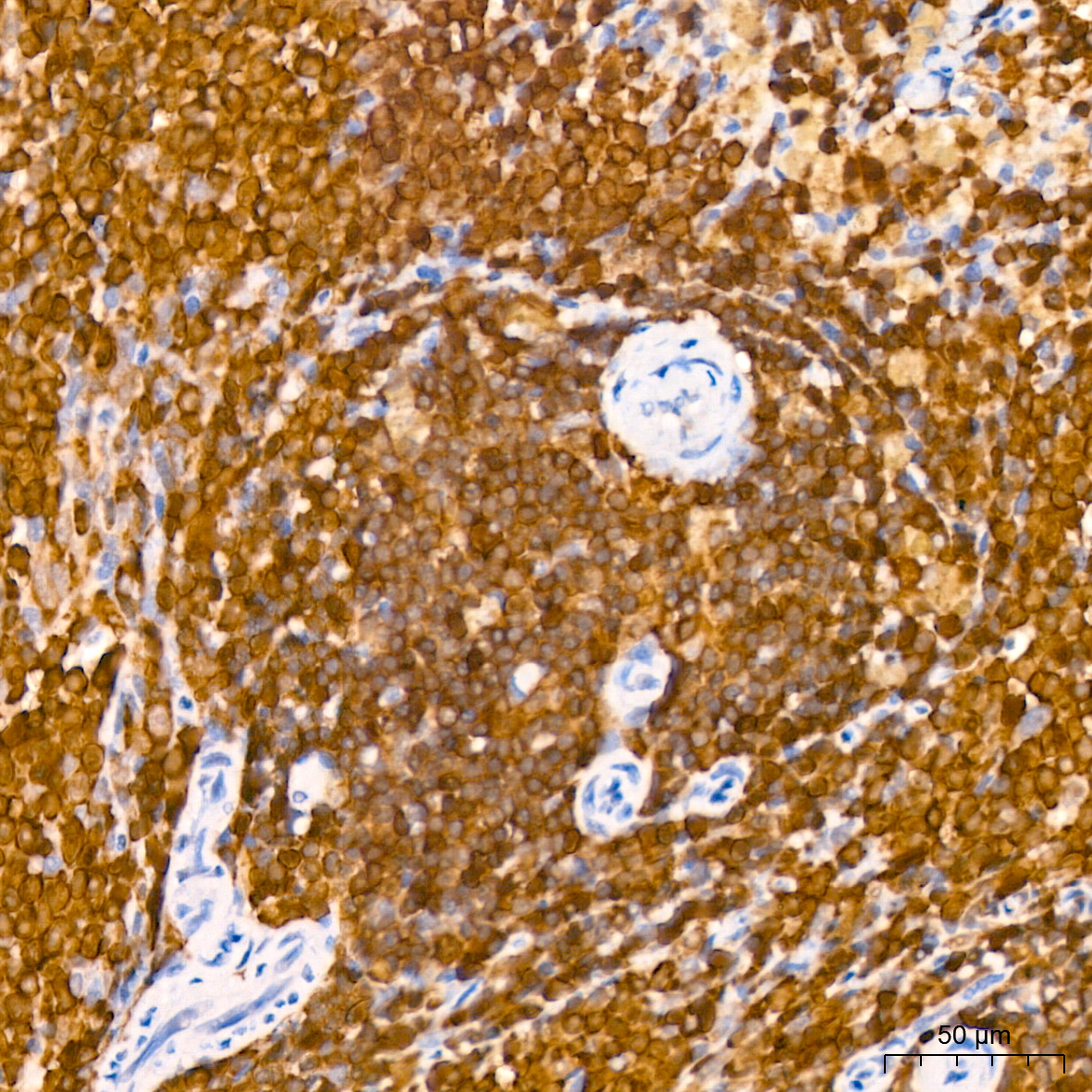 SHP1 Rabbit mAb