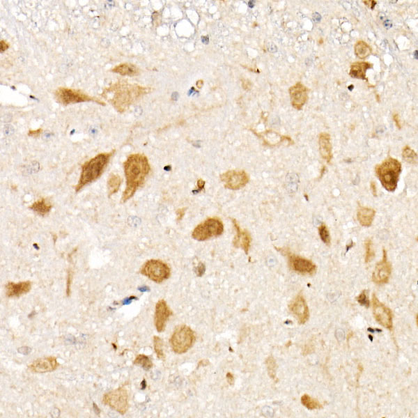[KO Validated] Smad1 Rabbit mAb
