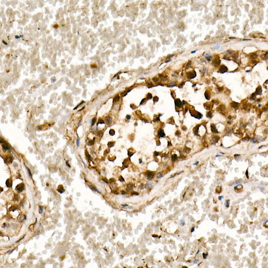 [KO Validated] Smad3 Rabbit mAb