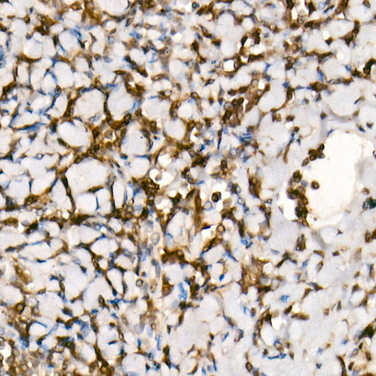 [KO Validated] Smad3 Rabbit mAb