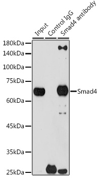 [KO Validated] Smad4 Rabbit mAb