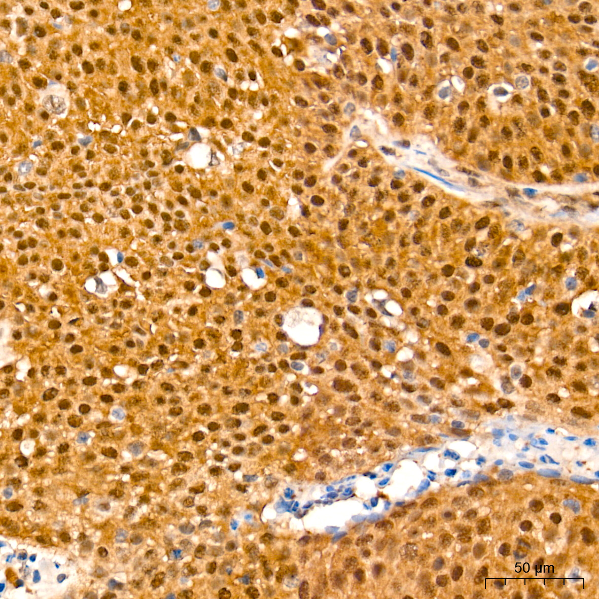 [KO Validated] Smad4 Rabbit mAb