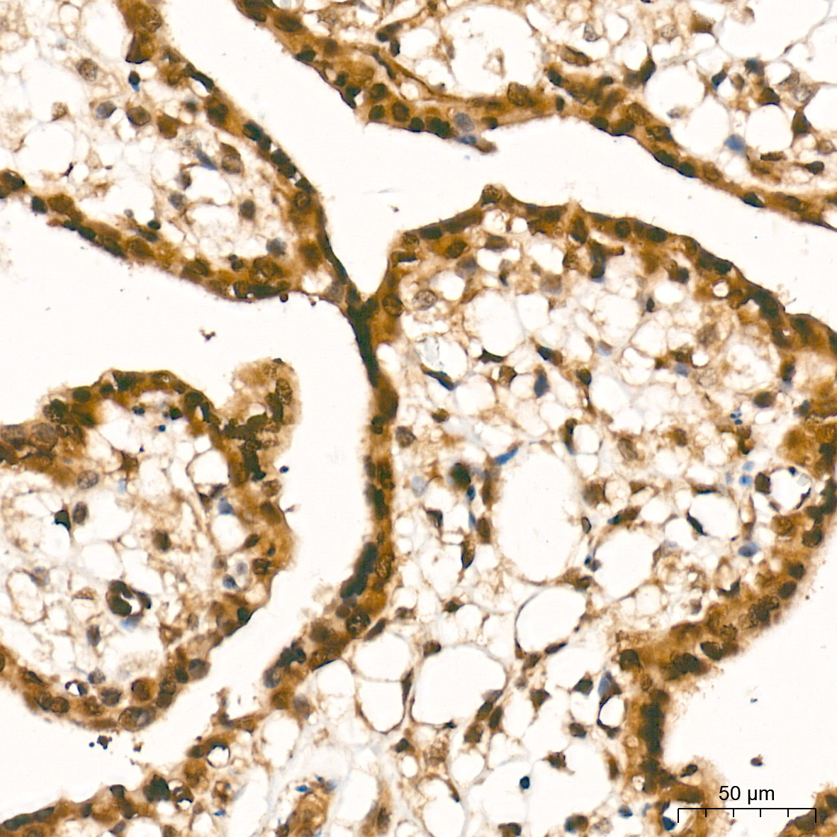 [KO Validated] Smad4 Rabbit mAb
