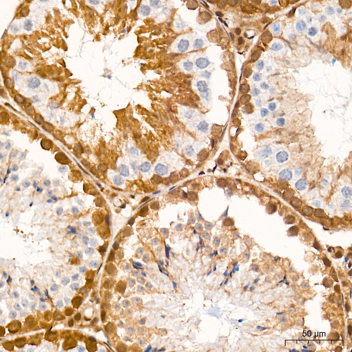 [KO Validated] Smad4 Rabbit mAb