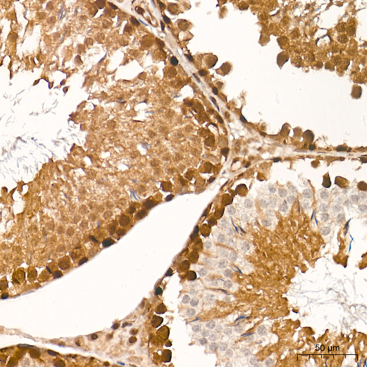[KO Validated] Smad4 Rabbit mAb
