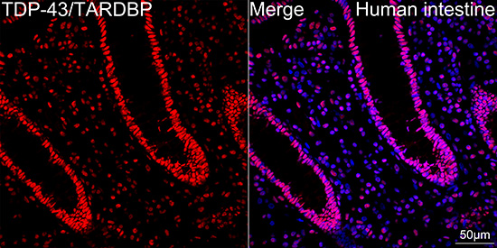 TDP-43/TARDBP Rabbit mAb