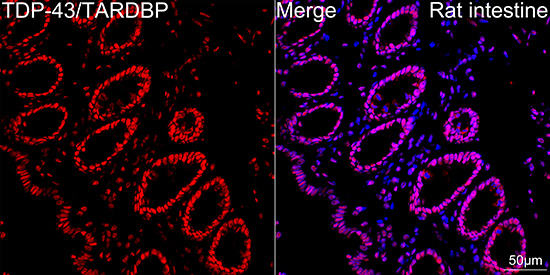 TDP-43/TARDBP Rabbit mAb