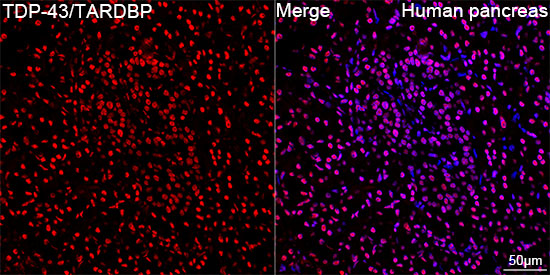 TDP-43/TARDBP Rabbit mAb