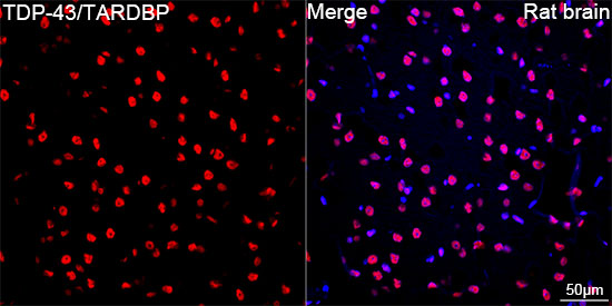 TDP-43/TARDBP Rabbit mAb