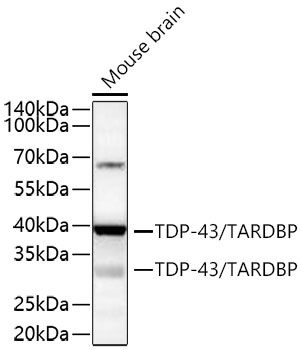 TDP-43/TARDBP Rabbit mAb