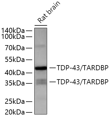 TDP-43/TARDBP Rabbit mAb