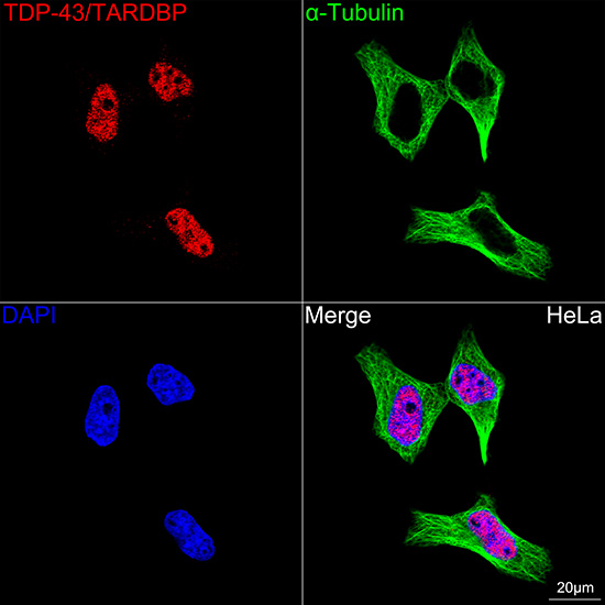 TDP-43/TARDBP Rabbit mAb