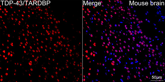 TDP-43/TARDBP Rabbit mAb