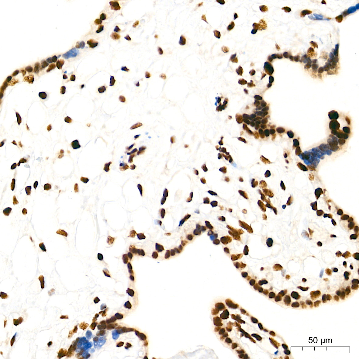 TDP-43/TARDBP Rabbit mAb