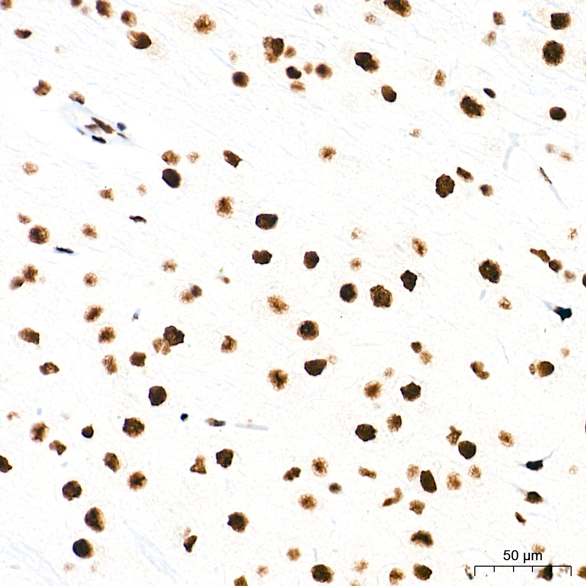 TDP-43/TARDBP Rabbit mAb