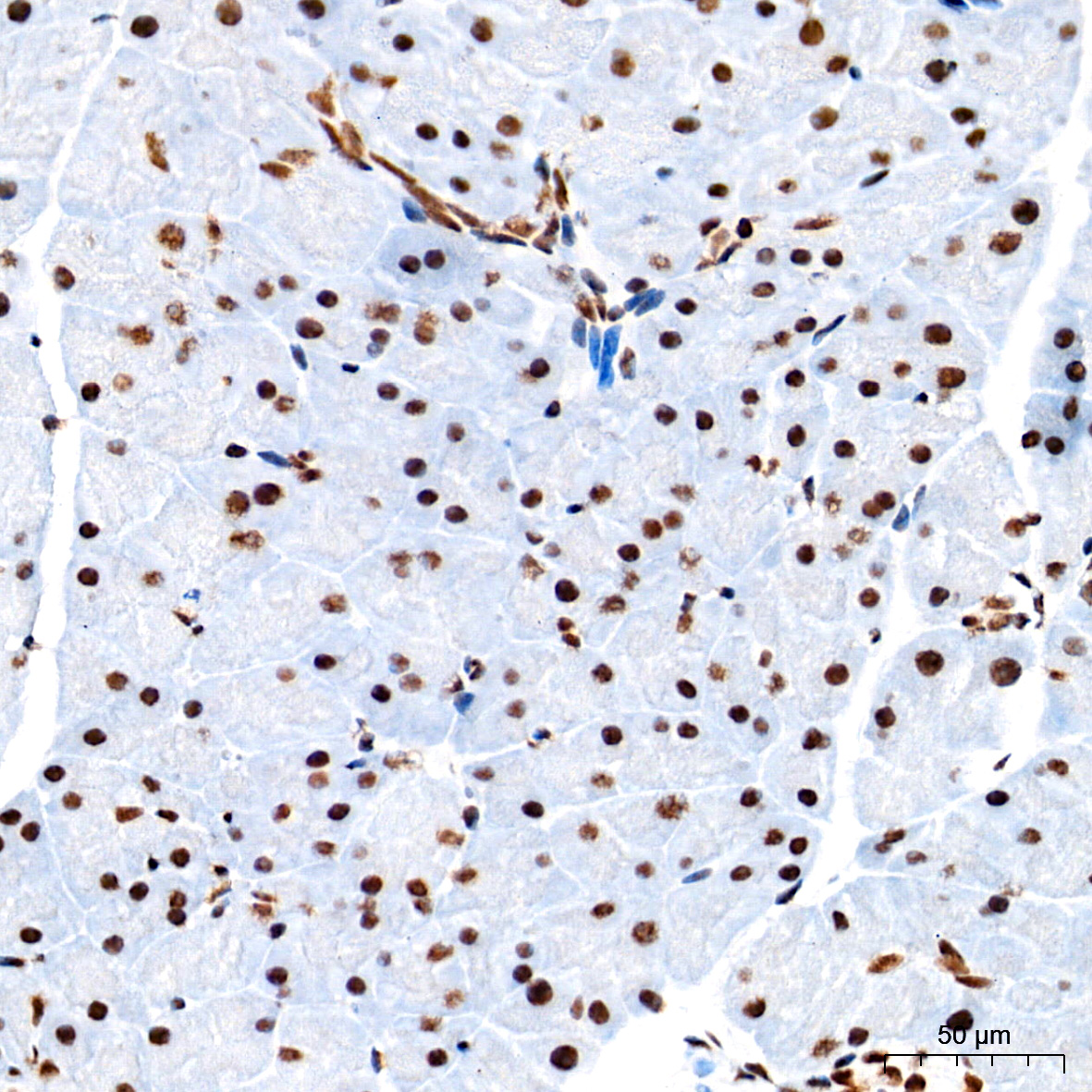 TDP-43/TARDBP Rabbit mAb