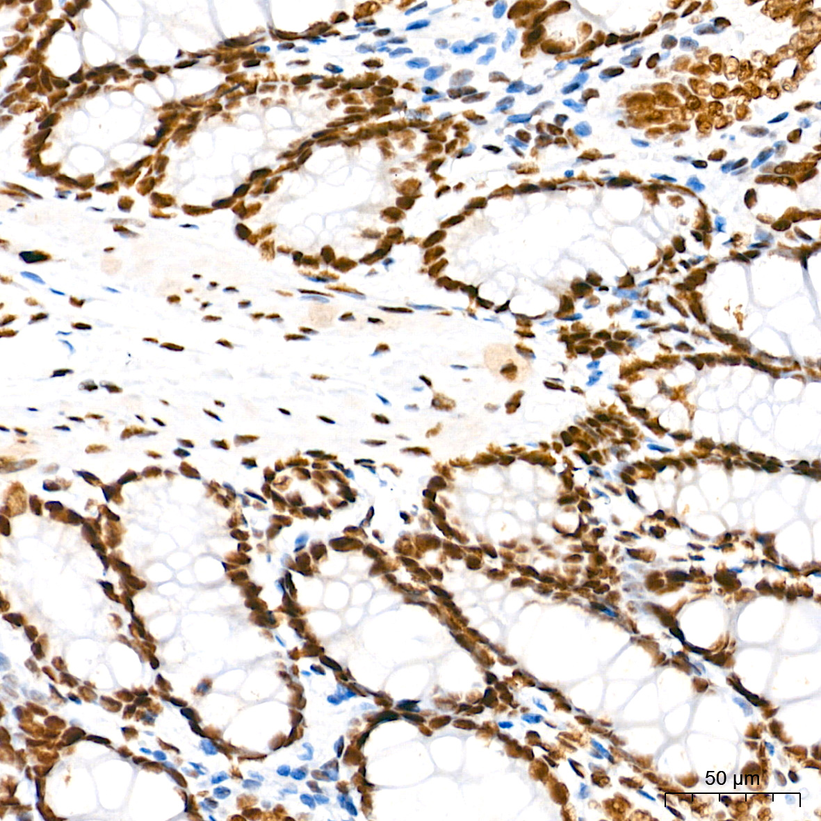 TDP-43/TARDBP Rabbit mAb