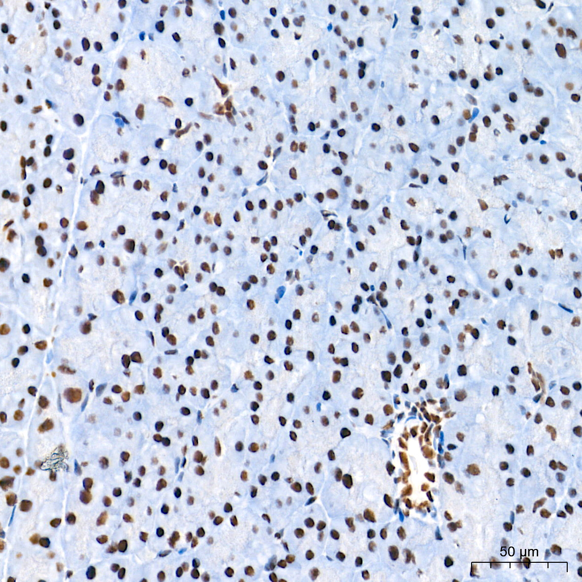 TDP-43/TARDBP Rabbit mAb