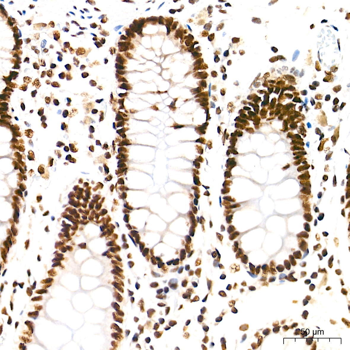 TDP-43/TARDBP Rabbit mAb