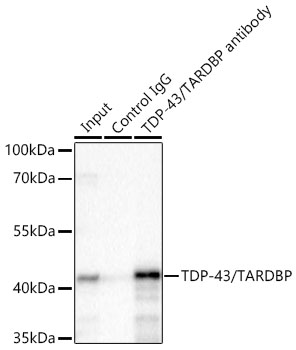 TDP-43/TARDBP Rabbit mAb