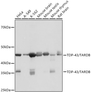 TDP-43/TARDBP Rabbit mAb