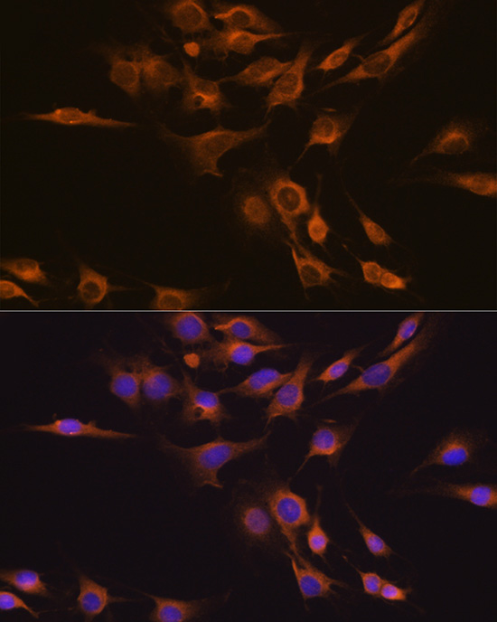 Immunofluorescence/Immunocytochemistry - CNTF Rabbit pAb (A1915)