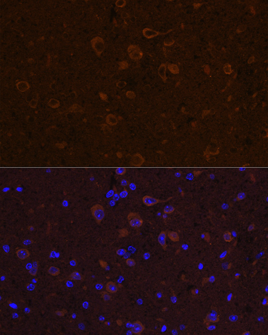 Immunofluorescence-Paraffin Embedded Fixed Tissue Sample - CNTF Rabbit pAb (A1915)