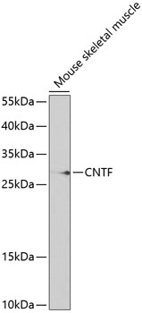 Western blot - CNTF Rabbit pAb (A1915)