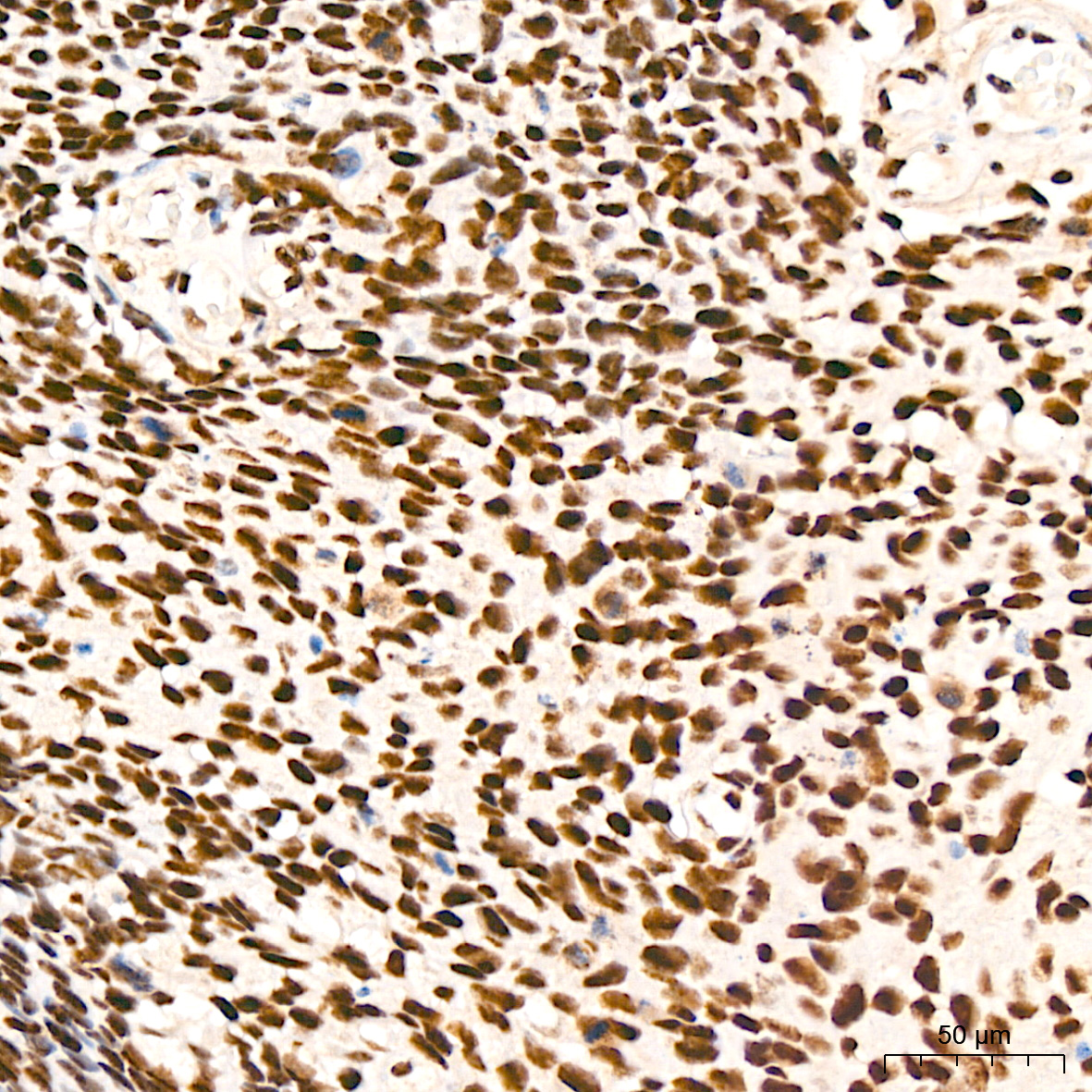 XPD/ERCC2 Rabbit mAb
