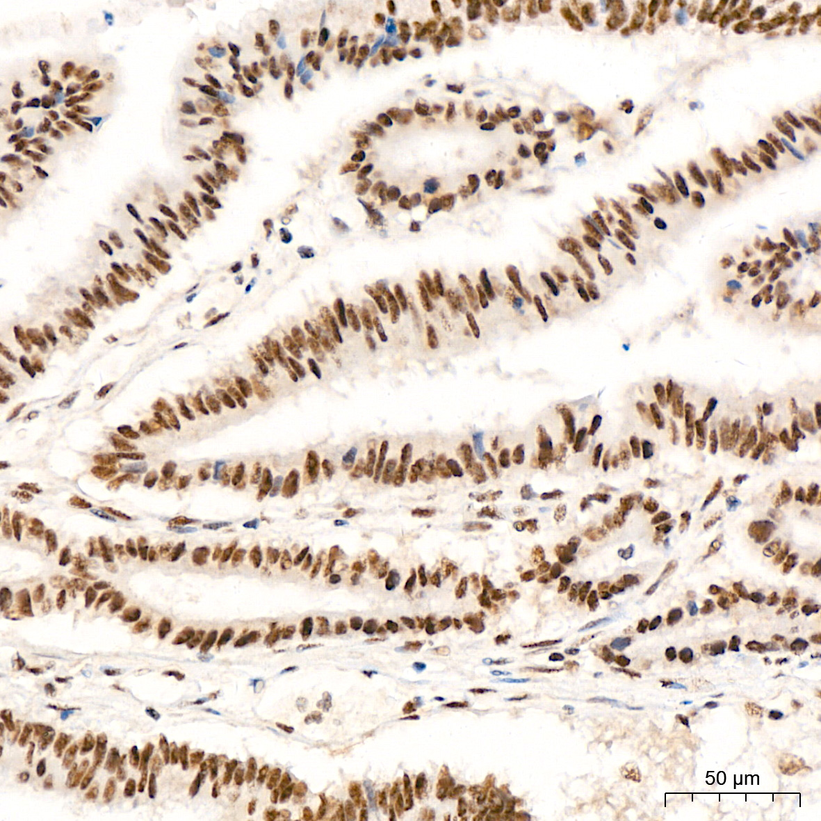 XPD/ERCC2 Rabbit mAb
