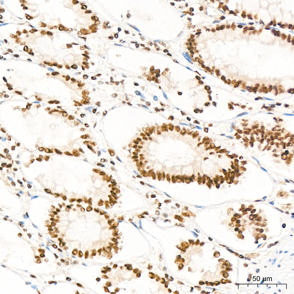 XPD/ERCC2 Rabbit mAb