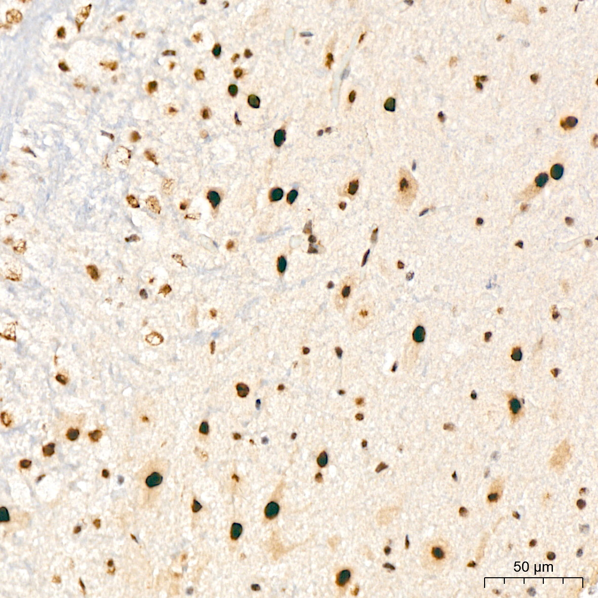 XPD/ERCC2 Rabbit mAb