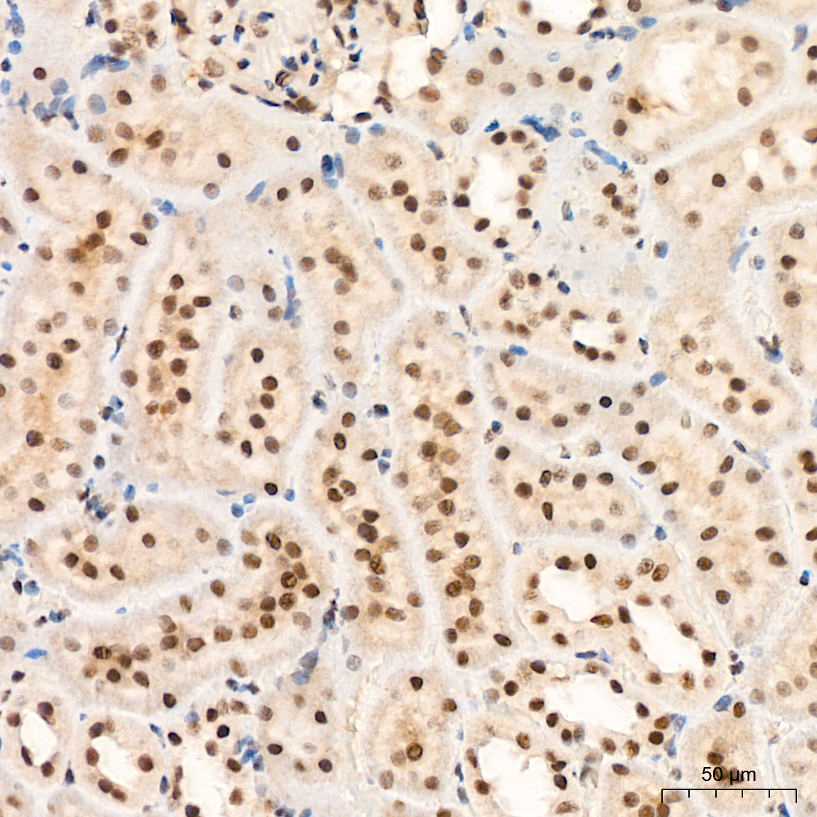 XPD/ERCC2 Rabbit mAb