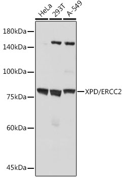 XPD/ERCC2 Rabbit mAb