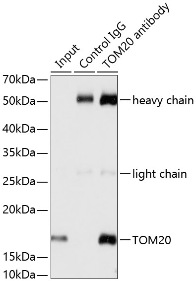 TOM20 Rabbit mAb