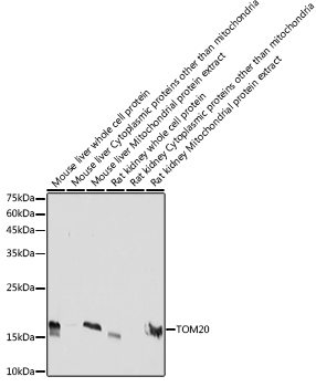 TOM20 Rabbit mAb