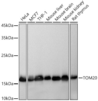 TOM20 Rabbit mAb