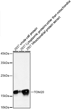 TOM20 Rabbit mAb