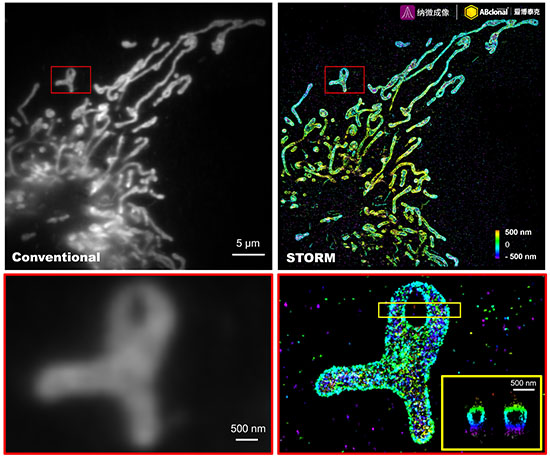 TOM20 Rabbit mAb