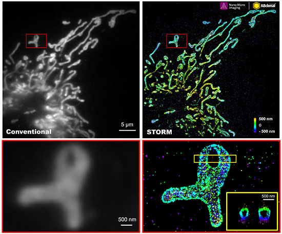TOM20 Rabbit mAb
