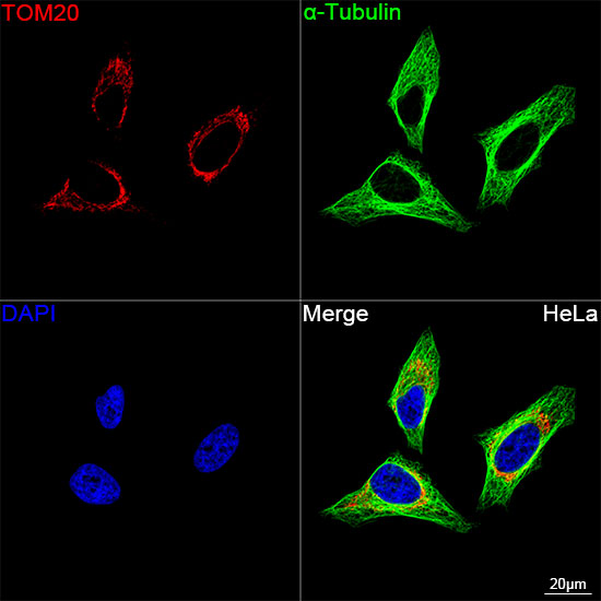 TOM20 Rabbit mAb
