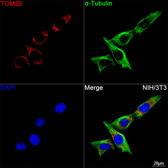 TOM20 Rabbit mAb