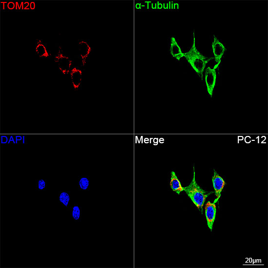 TOM20 Rabbit mAb
