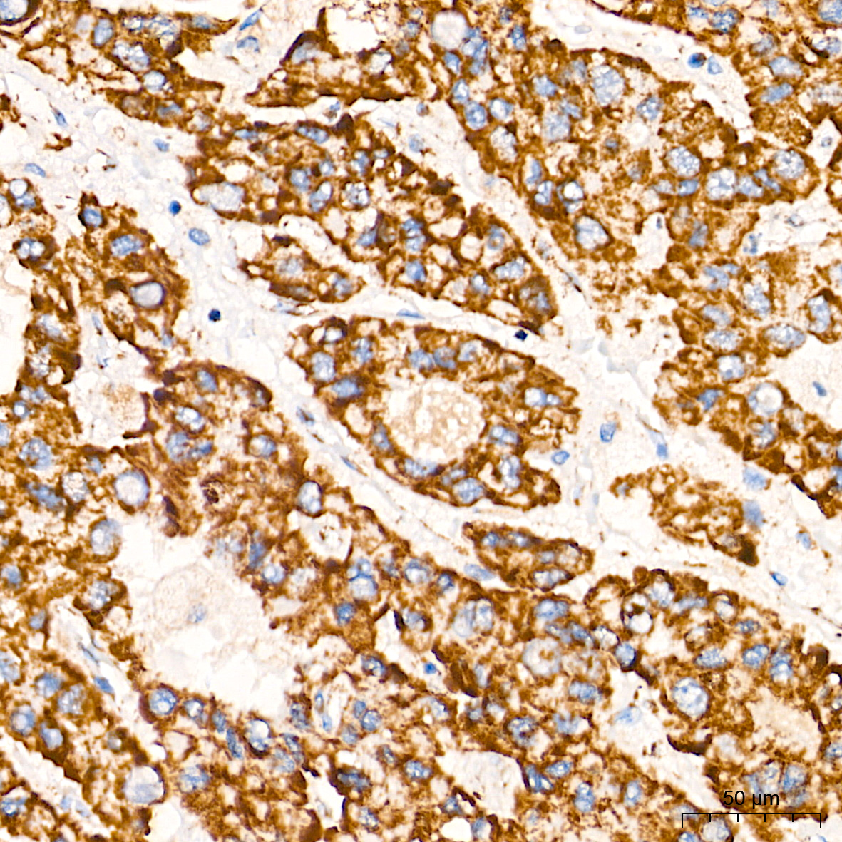 TOM20 Rabbit mAb