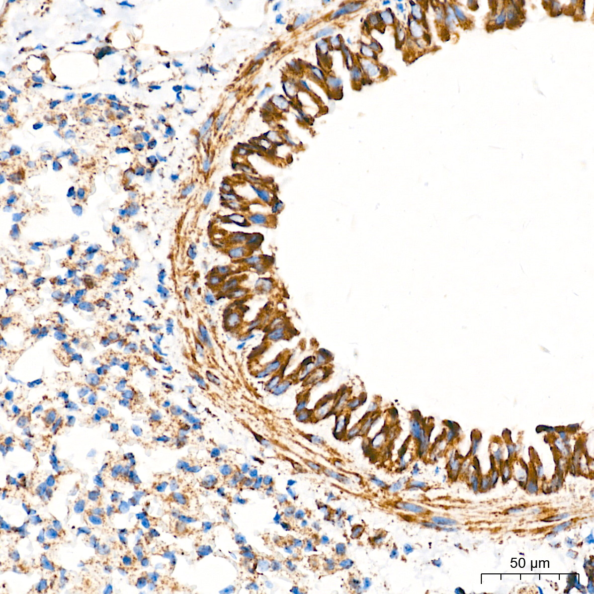 TOM20 Rabbit mAb