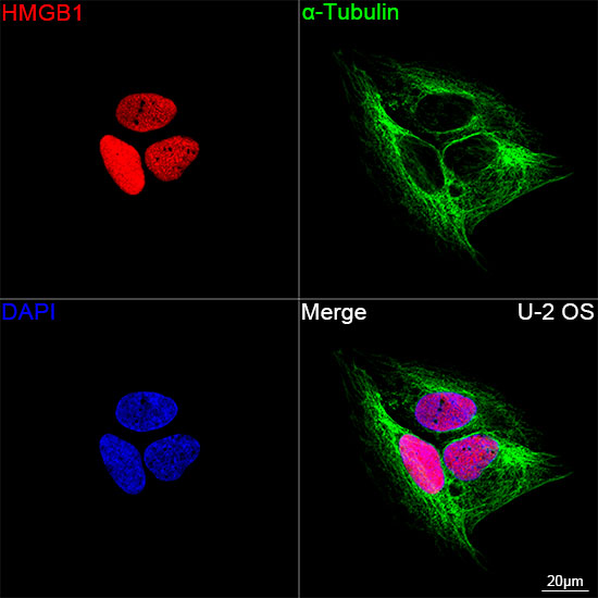 [KO Validated] HMGB1 Rabbit mAb