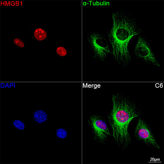 [KO Validated] HMGB1 Rabbit mAb