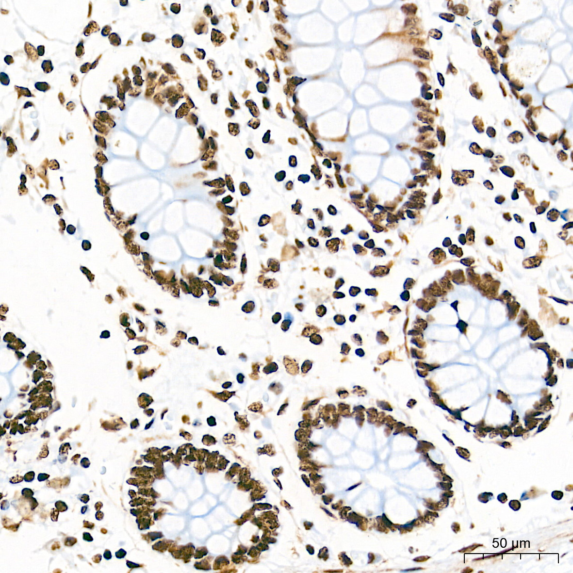 [KO Validated] HMGB1 Rabbit mAb