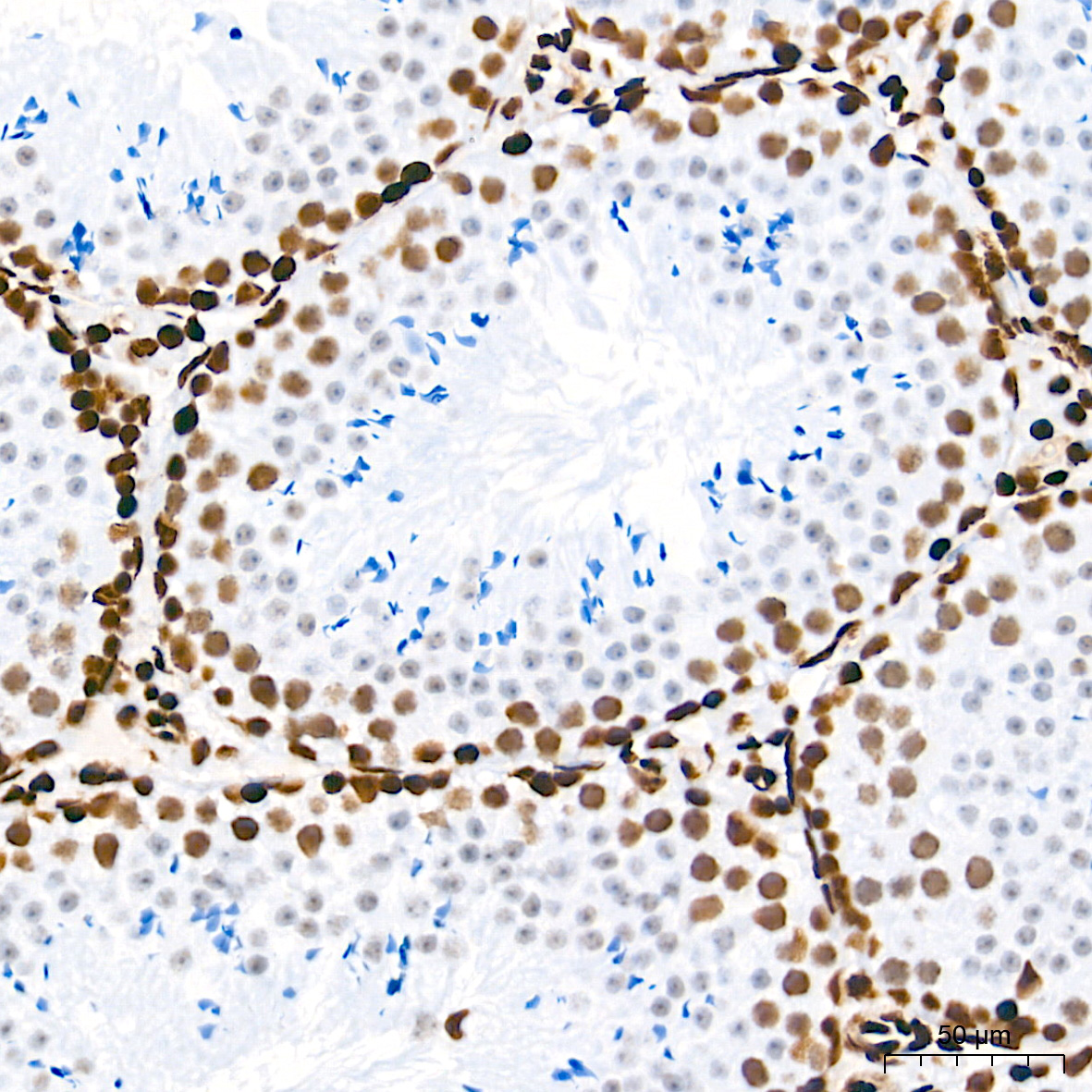 [KO Validated] HMGB1 Rabbit mAb